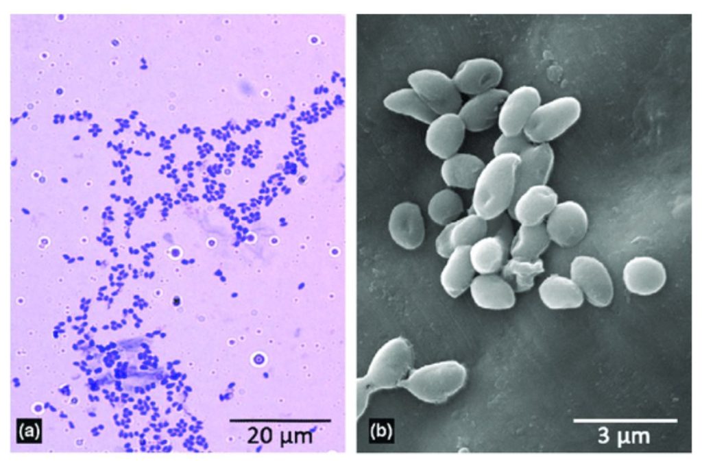 EHP dưới kính hiểu vi