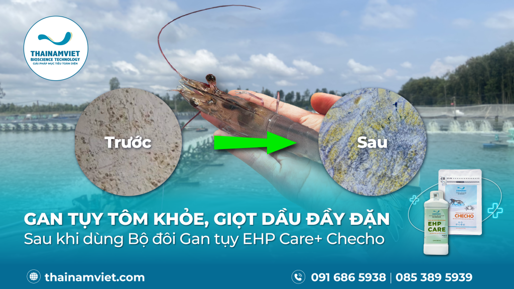 GAN TỤY TÔM KHỎE, GIỌT DẦU ĐẦY ĐẶN SAU KHI DÙNG EHP CARE & CHECHO 1 WebSocial Post T7 26 Feedback bo doi gan tuy Webpost banner 1920 x 1080 02