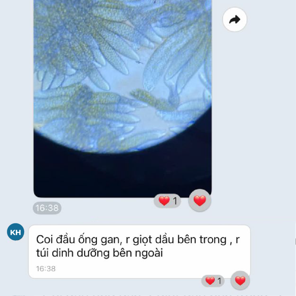 GAN TỤY TÔM KHỎE, GIỌT DẦU ĐẦY ĐẶN SAU KHI DÙNG EHP CARE & CHECHO 5 WebSocial Post T7 26 review khach dung bo doi gan tuy 29